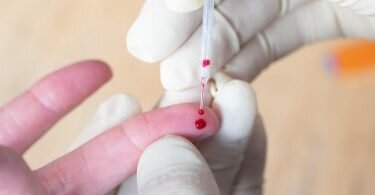 Für einen Corona-Antikörpertest muss Blut abgenommen werden. Foto: Daniel Reinhardt/dpa/dpa-tmn