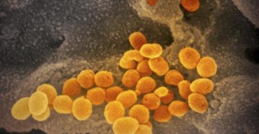 Das Coronavirus passt sich durch Mutationen ständig seinem neuen Wirt, dem Menschen, an. Wie gefährlich die neue Virusvariante ist, wurde noch nicht abschließend geklärt. Foto: NIAID-RML/AP/dpa