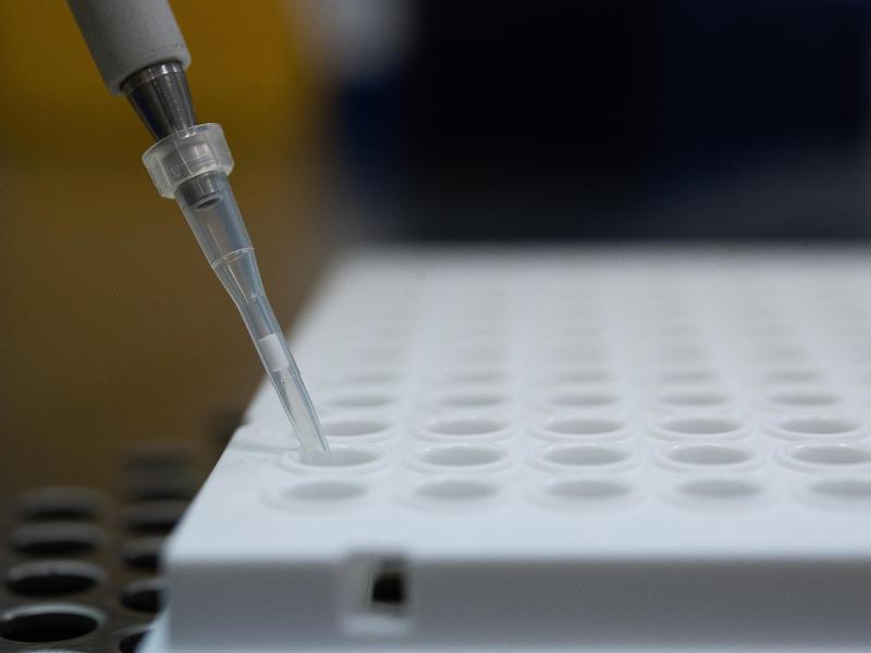 Ein PCR-Test in einem Labor in Stuttgart. Virologin Brinkmann fordert einen vermehrten Einsatz sogenannter Lollitests oder Gurgeltests. Diese können per PCR ausgewertet werden. Foto: Sebastian Gollnow/dpa