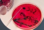 Blick in eine Petrischale mit Salmonellen: Die durch Lebensmittel übertragbaren Infektionen führen oft zu Magen-Darm-Erkrankungen. Foto: Arno Burgi/dpa-Zentralbild/dpa