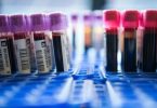 Spezielle Tests können Erbgut von Krebszellen im Blut nachweisen. Foto: picture alliance / dpa