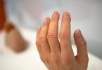 Aus Silikon hergestellte Prothesen für Finger und Hand können täuschend echt aussehen. Foto: Emily Wabitsch/dpa/dpa-tmn