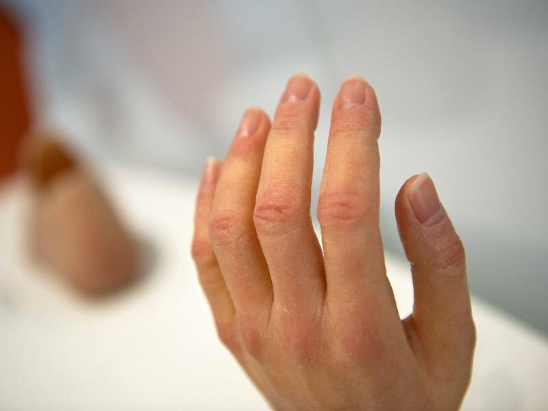 Aus Silikon hergestellte Prothesen für Finger und Hand können täuschend echt aussehen. Foto: Emily Wabitsch/dpa/dpa-tmn