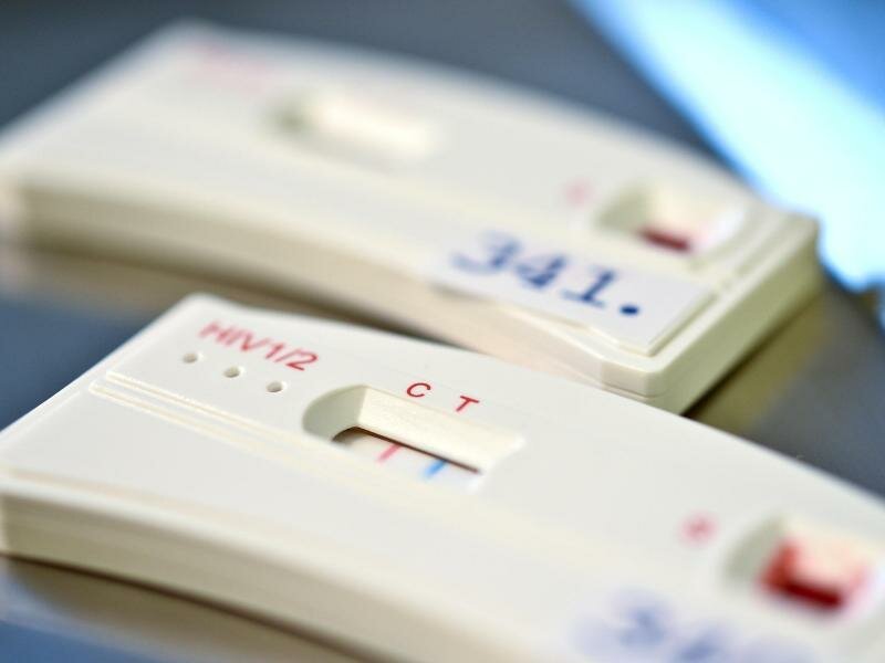Ein HIV-Schnelltest ist 12 Wochen nach dem Sex verlässlich. Foto: Britta Pedersen/dpa-Zentralbild/dpa