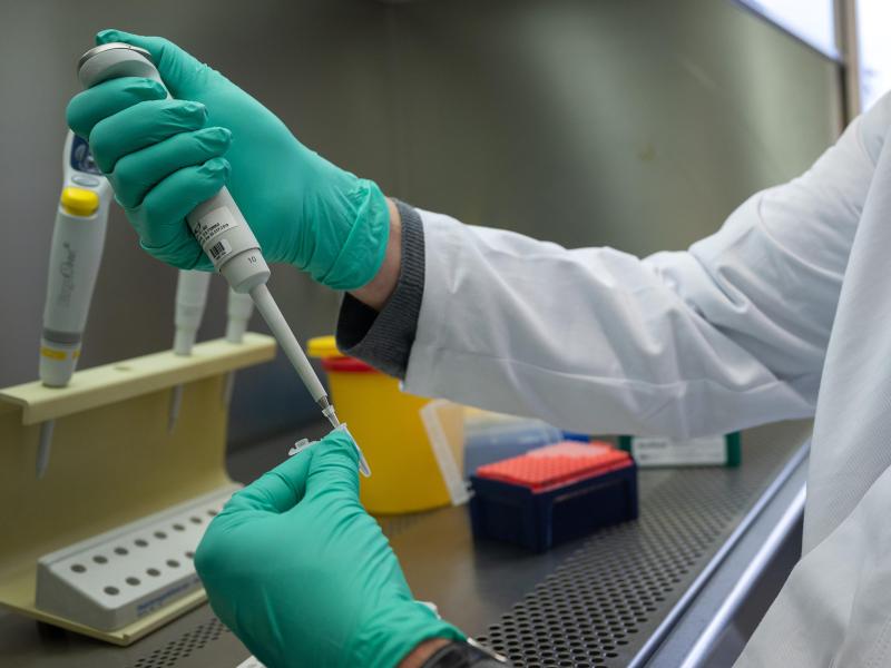 Ein Forscher zeigt im Landesgesundheitsamt Baden-Württemberg, wie ein PCR-Test für die Analyse auf Mutationen des Coronavirus vorbereitet wird. Foto: Sebastian Gollnow/dpa