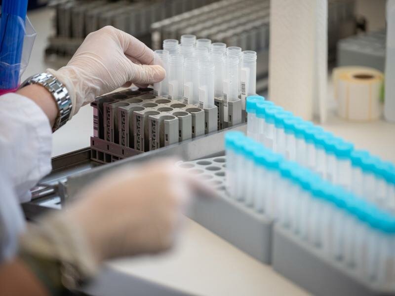 Das RKI gibt die Zahl der sicher nachgewiesenen und wahrscheinlichen Omikron-Fälle mit 3198 an. Foto: Sebastian Gollnow/dpa