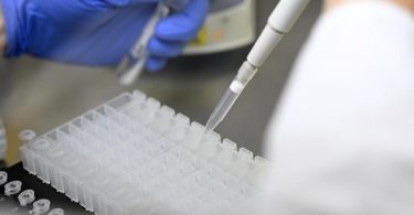Eine Mitarbeiterin des PCR-Testlabors des Robert Bosch Krankenhauses bereitet PCR-Tests vor. (Archivbild). Foto: Bernd Weißbrod/dpa