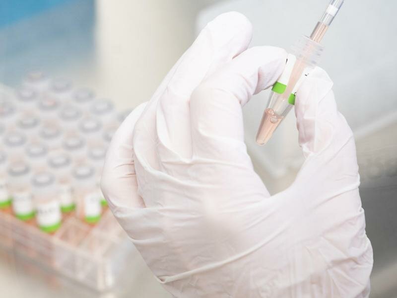 Eine biologisch-technische Assistentin bereitet PCR-Tests auf das Coronavirus vor. Foto: Julian Stratenschulte/dpa