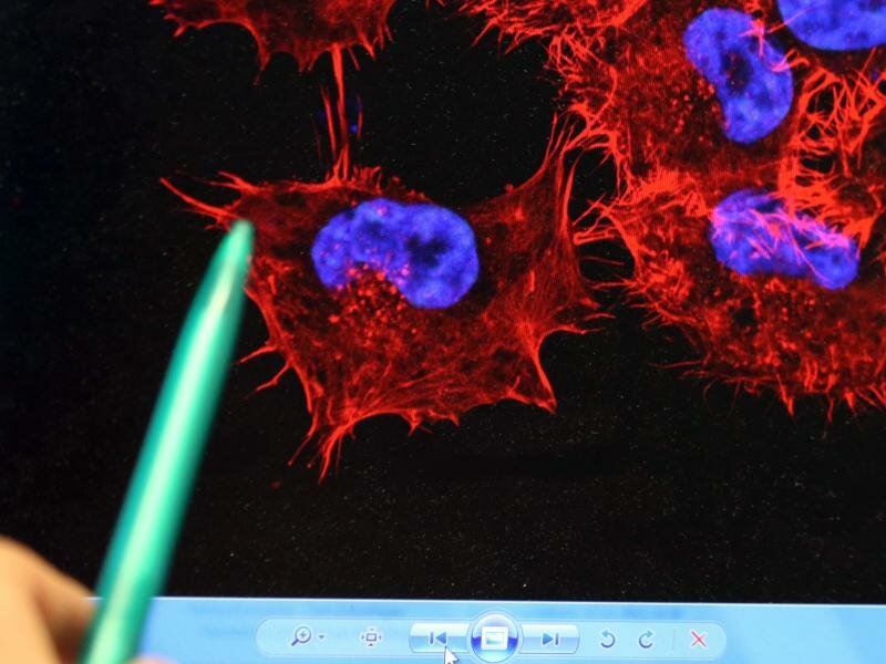 Forschende an den Unikliniken Rostock (UMR) und Greifswald (UMG) wollen das Immunsystem bei der Bekämpfung von Hautkrebs stärker einbinden. Ihre Ergebnisse aus Labor- und Tierversuche bezeichnen sie als vielversprechend. Foto: Bernd Wüstneck/dpa-Zentralbild/dpa/Symbolbild