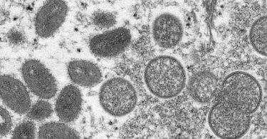 Eine elektronenmikroskopische Aufnahme zeigt reife, ovale Affenpockenviren (l) und kugelförmige unreife Virionen (r). Foto: Cynthia S. Goldsmith/Russell Regner/CDC/AP/dpa