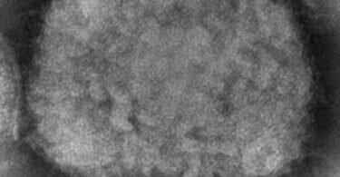 Vernunft statt Angst: Die Aidshilfe spricht sich im Umgang mit Affenpocken gegen Stigmatisierung aus. Foto: Cynthia S. Goldsmith/CDC via AP/dpa