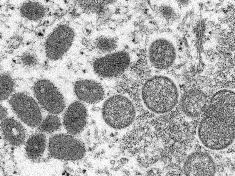 Das Affenpocken-Virus verursacht meist nur milde Symptome. Foto: Cynthia S. Goldsmith/Russell Regner/CDC/AP/dpa