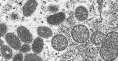 Eine elektronenmikroskopische Aufnahme zeigt reife, ovale Affenpockenviren (l) und kugelförmige unreife Virionen (r). Foto: Cynthia S. Goldsmith/Russell Regner/CDC/AP/dpa