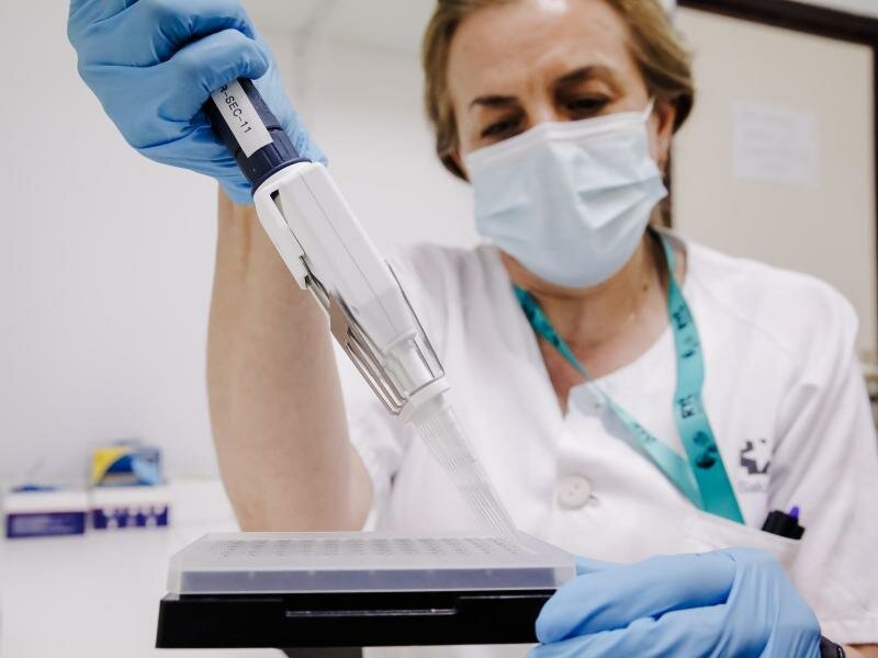 Mithilfe von PCR-Tests können Affenpocken nachgewiesen werden. In Deutschland meldet das RKI 113 Fälle. Foto: Carlos Luján/EUROPA PRESS/dpa