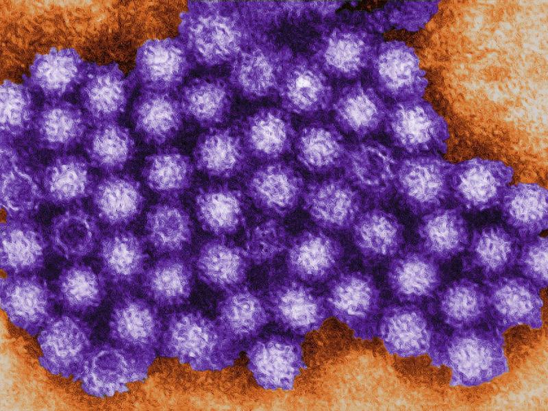 Ein digital eingefärbtes transmissionselektronenmikroskopisches (TEM) Bild zeigt ein Cluster von Noroviren. Foto: Charles D. Humphre/CDC/dpa