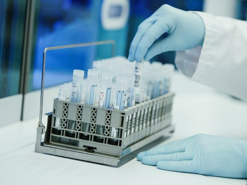 Den RKI-Daten zufolge ist BA.5 immer noch für den Großteil der Corona-Infektionen in Deutschland verantwortlich. Foto: Uwe Anspach/dpa