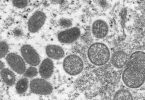 Der Affenpocken-Ausbruch gilt nun als «Notlage von internationaler Tragweite». Foto: Cynthia S. Goldsmith/Russell Regner/CDC/AP/dpa
