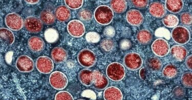 Rund drei Monate nach dem ersten Affenpocken-Nachweis in Deutschland spricht das Robert Koch-Institut (RKI) erstmals von bekannt gewordenen Ansteckungen bei Minderjährigen. Foto: Niaid/Niaid/Planet Pix via ZUMA Press Wire/dpa