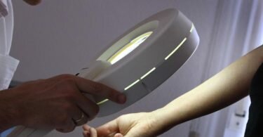 Wer vermutet, eine aktinische Keratose zu haben, sollte zu einem Hautarzt gehen. Foto: Karl-Josef Hildenbrand/dpa-tmn