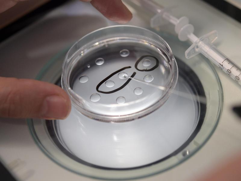 Eine Biologin in einer Kinderwunschpraxis präpariert Eizellen. Foto: Rainer Jensen/dpa
