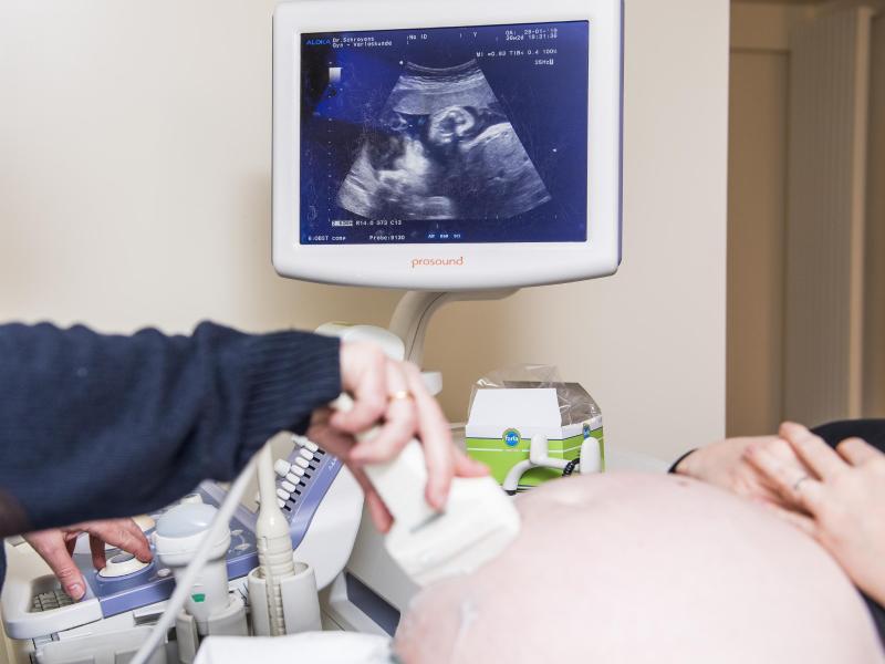 Ein Arzt untersucht eine schwangere Frau mit einem Ultraschallgerät während der Fötus im Mutterbauch auf einem Display zu sehen ist. Foto: Jasper Jacobs/BELGA/dpa